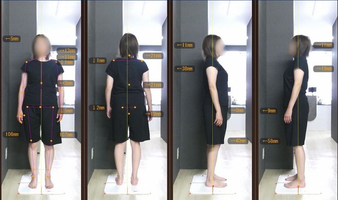 センサーカメラ映像 施術後