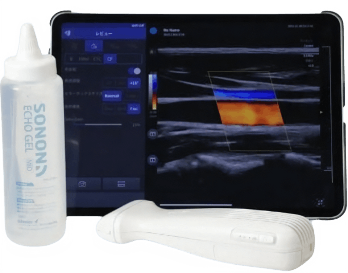 超音波画像診断装置 SONON