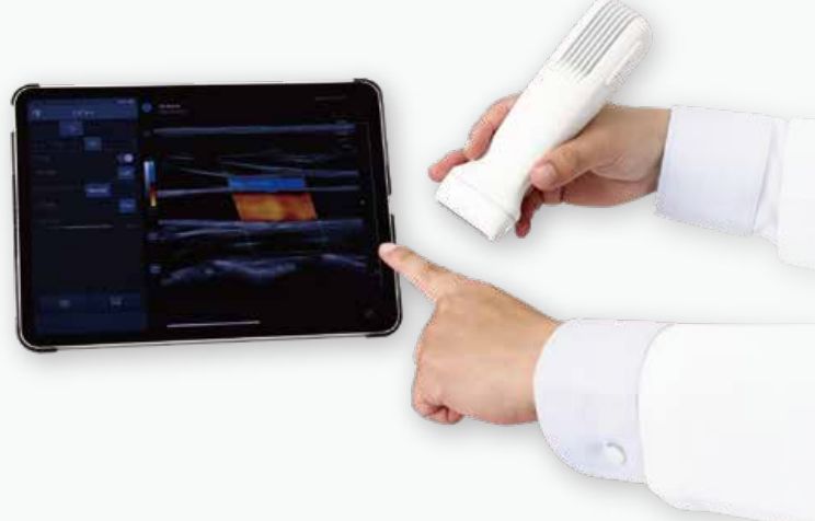 超音波画像診断装置 SONON 使用イメージ